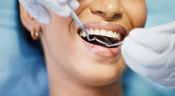 Best Emergency Root Canal Treatment in Warrensburg, MO